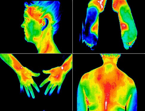Thermo scans of head feet hands and back
